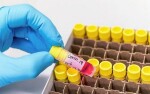 Metropolis among private labs short-listed for coronavirus testing